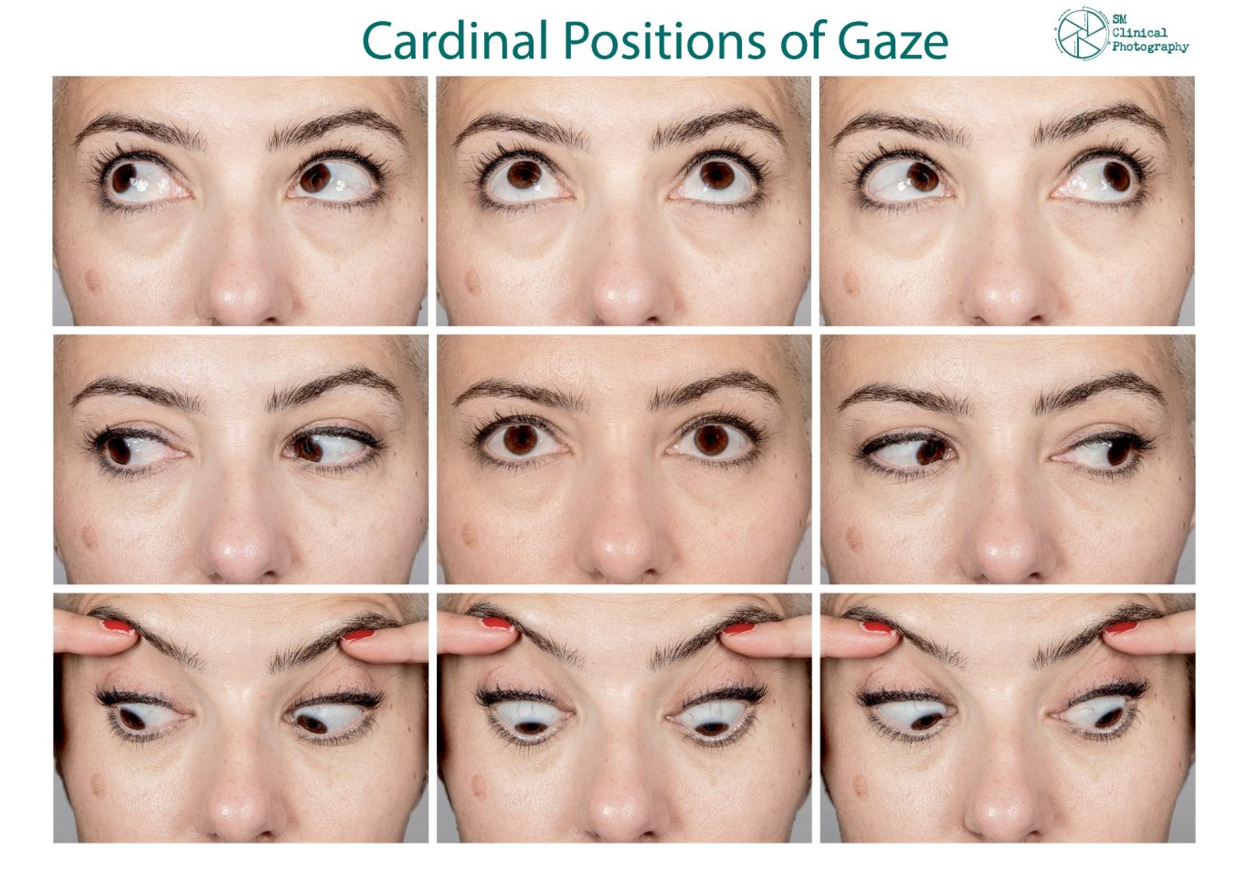 Standardised Clinical Photography